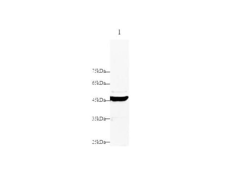 Anti-Human DNase-Ⅰ Antibody - ABMIUM