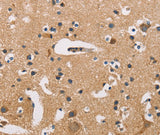 Anti-Human/Mouse/Rat ATP2C1 Antibody - ABMIUM