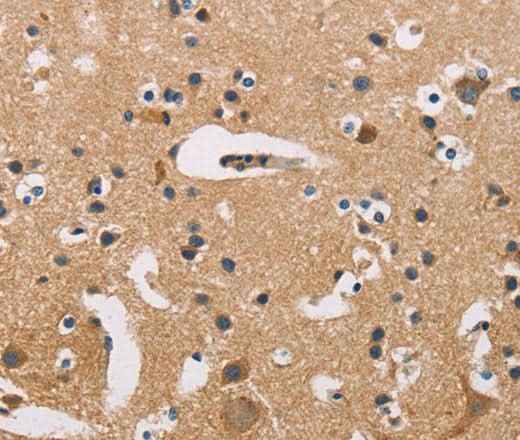 Anti-Human/Mouse/Rat ATP2C1 Antibody