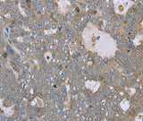 Anti-Human/Mouse FAR2 Antibody - ABMIUM
