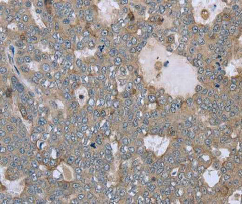 Anti-Human/Mouse FAR2 Antibody