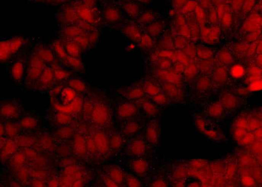 Anti-Human OTUB2 Antibody [B361] - ABMIUM