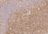 Anti-Human CD58 Antibody [B170]