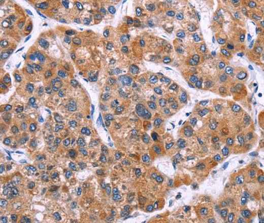 Anti-Human MSMO1 Antibody