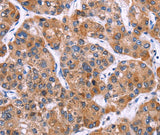 Anti-Human MSMO1 Antibody - ABMIUM