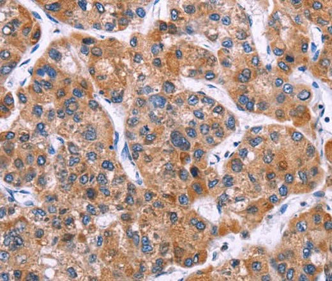 Anti-Human MSMO1 Antibody - ABMIUM