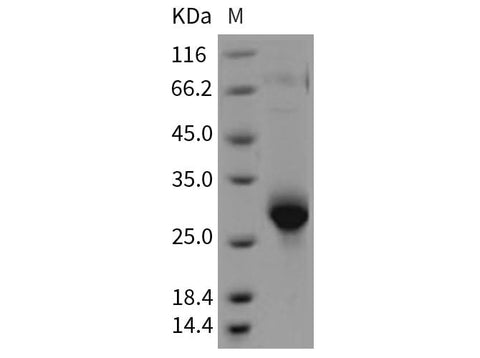 Recombinant Rat CLM-9/TREM4 Protein (His Tag) - ABMIUM