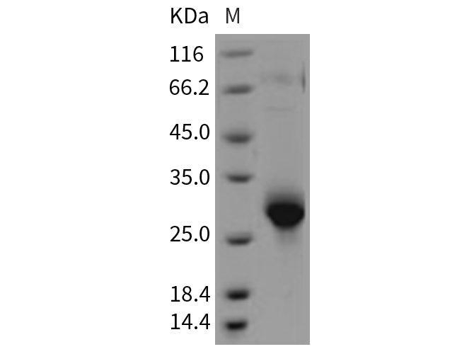 Recombinant Rat CLM-9/TREM4 Protein (His Tag) - ABMIUM
