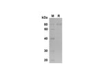 SDS-PAGE analysis of Mouse E-Cadherin proteins , 2 μg/lane of Recombinant Mouse E-Cadherin proteins was resolved with SDS-PAGE under reducing conditions , showing bands at 80 kDa.