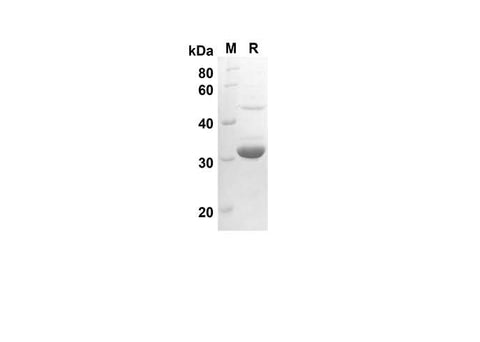 SDS-PAGE analysis of Rat Cst3 proteins, 2 μg/lane of Recombinant Rat Cst3 proteins was resolved with an SDS-PAGE under reducing conditions, showing bands at 26 kDa.