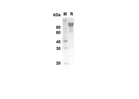 SDS-PAGE analysis of Human PODXL proteins, 2 μg/lane of Recombinant Human PODXL proteins was resolved with SDS-PAGE under reducing conditions, showing bands at 73.2 kDa.