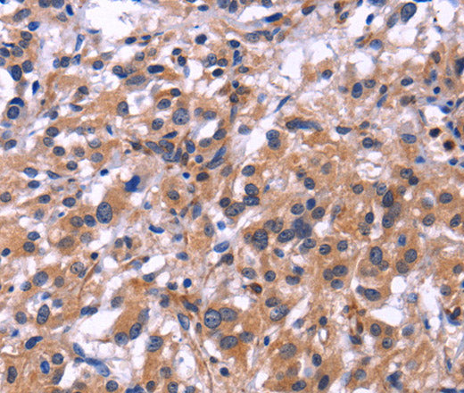 Anti-Human SIGLEC5 Antibody - ABMIUM