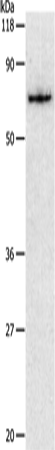 Anti-Human/Mouse/Rat PKM2 Antibody - ABMIUM