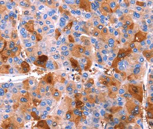 Anti-Human ERN2 Antibody