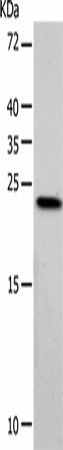 Western blot analysis of Hela cells using VSNL1 Polyclonal Antibody at dilution of 1:900