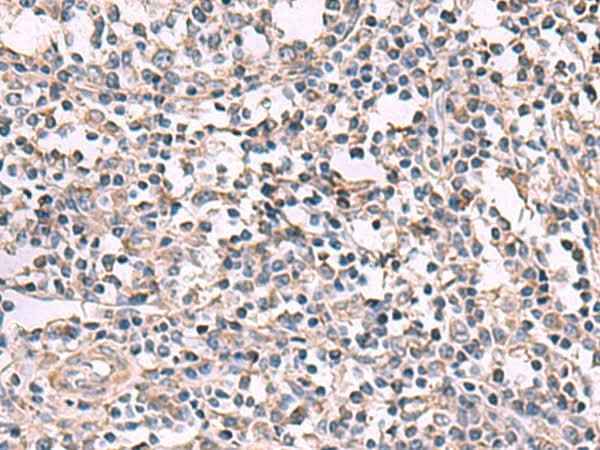 Anti-Human KCNK18 Antibody