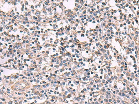 Immunohistochemistry of paraffin-embedded Human tonsil tissue using KCNK18 Polyclonal Antibody at dilution of 1:80(×200)