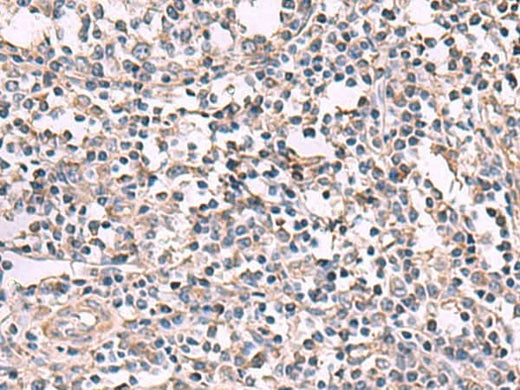 Immunohistochemistry of paraffin-embedded Human tonsil tissue using KCNK18 Polyclonal Antibody at dilution of 1:80(×200)