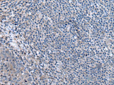 Immunohistochemistry of paraffin-embedded Human tonsil tissue using CCK Polyclonal Antibody at dilution of 1:55. (Original magnific at ion: ×200) at dilution of 1:55(×200)
