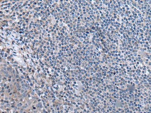 Immunohistochemistry of paraffin-embedded Human tonsil tissue using CCK Polyclonal Antibody at dilution of 1:55. (Original magnific at ion: ×200) at dilution of 1:55(×200)
