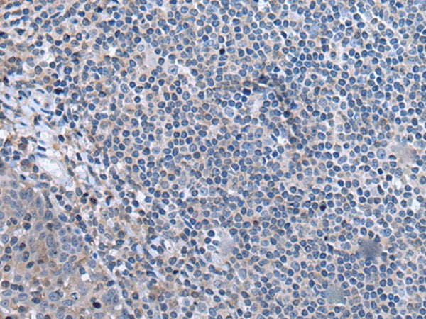 Immunohistochemistry of paraffin-embedded Human tonsil tissue using CCK Polyclonal Antibody at dilution of 1:55. (Original magnific at ion: ×200) at dilution of 1:55(×200)