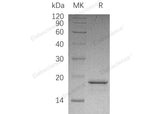 Recombinant Human PFDN2 Protein (His Tag) - ABMIUM