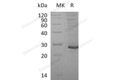 Recombinant Human Proteoglycan 3/PRG3 Protein (His Tag) - ABMIUM