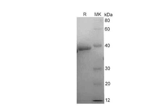 SDS-PAGE analysis of Human Arginase-1 proteins, 2 μg/lane of Recombinant Human Arginase-1 proteins was resolved with SDS-PAGE under reducing conditions, showing bands at 38-40 kDa.