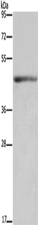 Anti-Human/Mouse IL5RA Antibody - ABMIUM