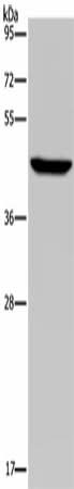 Anti-Human PDSS2 Antibody - ABMIUM