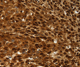 Anti-Human/Rat SCN1A/2A/3A/4A/5A/8A/9A/10A/11A/13A Antibody - ABMIUM