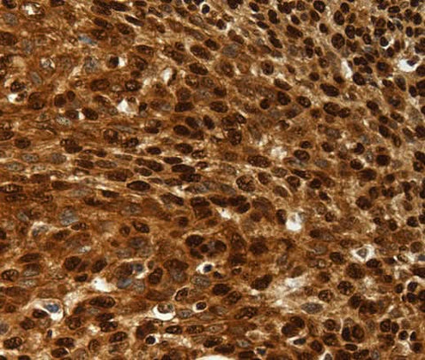 Anti-Human/Rat SCN1A/2A/3A/4A/5A/8A/9A/10A/11A/13A Antibody - ABMIUM