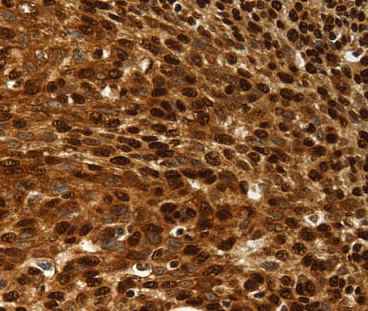 Anti-Human/Rat SCN1A/2A/3A/4A/5A/8A/9A/10A/11A/13A Antibody - ABMIUM