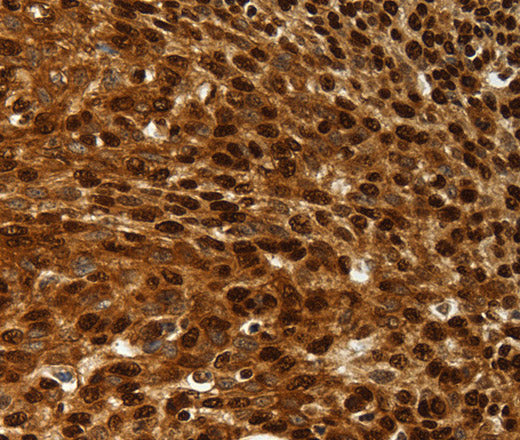 Anti-Human/Rat SCN1A/2A/3A/4A/5A/8A/9A/10A/11A/13A Antibody - ABMIUM