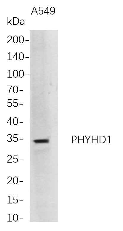Anti-Human PHYHD1 Antibody [B694] - ABMIUM