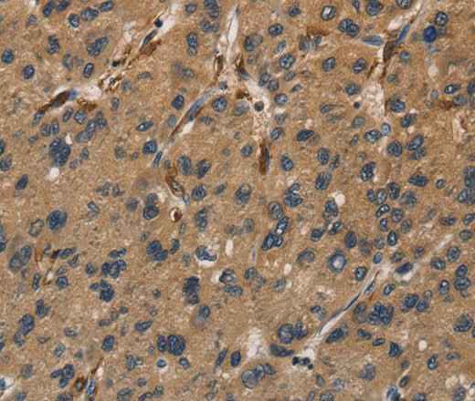 Anti-Human/Mouse/Rat UBE2S Antibody