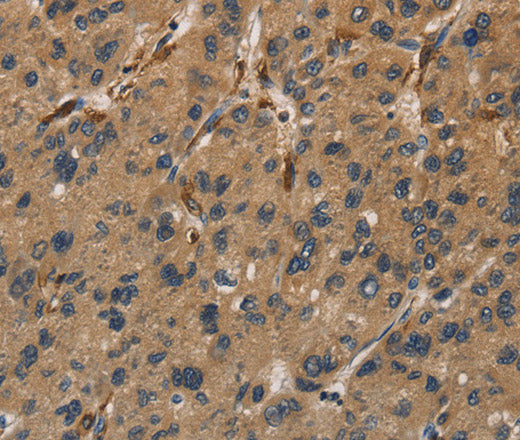 Anti-Human/Mouse/Rat UBE2S Antibody - ABMIUM