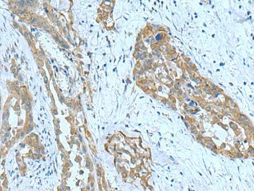 Anti-Human/Mouse SRPK2 Antibody