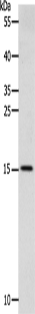 Anti-Human CST3 Antibody - ABMIUM