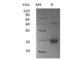 Recombinant Human DUSP3/VHR Protein (His Tag) - ABMIUM