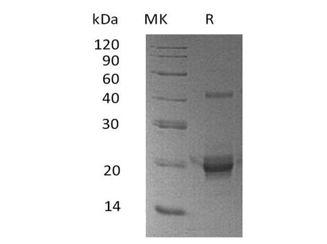 Recombinant Human DUSP3/VHR Protein (His Tag) - ABMIUM