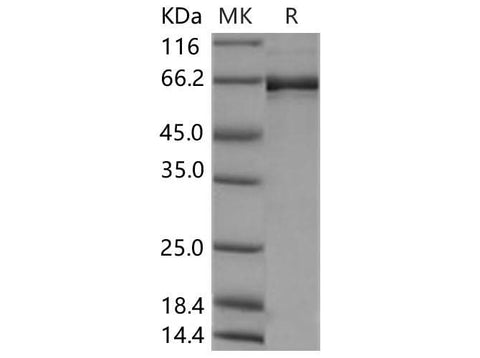 Recombinant Human EphB2 Protein (aa 570-987, His &GST Tag) - ABMIUM