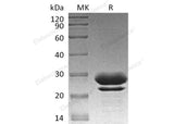 Recombinant Human PPIase/FKBP7 Protein (aa 24-222, His Tag) - ABMIUM