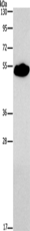 Anti-Human/Mouse SMAD9 Antibody - ABMIUM