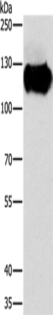 Anti-Human CAST Antibody - ABMIUM