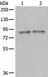 Western blot analysis of Mouse brain tissue and Rat brain tissue lysates using DDX1 Polyclonal Antibody at dilution of 1:300
