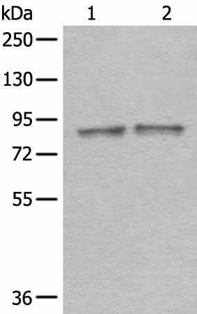 Western blot analysis of Mouse brain tissue and Rat brain tissue lysates using DDX1 Polyclonal Antibody at dilution of 1:300