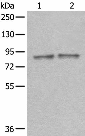 Western blot analysis of Mouse brain tissue and Rat brain tissue lysates using DDX1 Polyclonal Antibody at dilution of 1:300