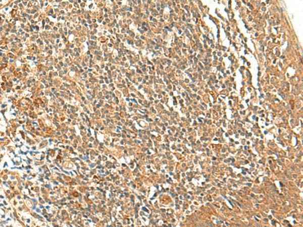 Anti-Human/Mouse/Rat TSHB Antibody
