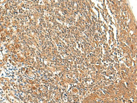 Anti-Human/Mouse/Rat TSHB Antibody - ABMIUM